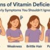 Signs of Vitamin Deficiency