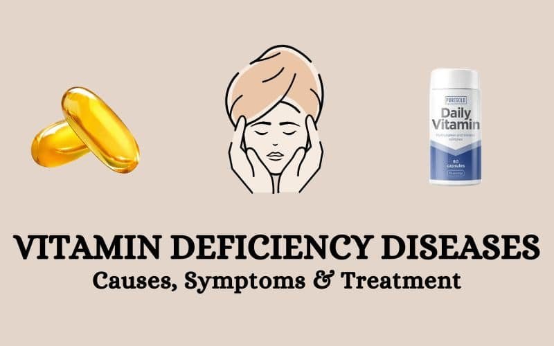 Vitamin deficiency diseases