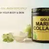 Signs-of-Collagen-Deficiency